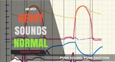 Are Split Heart Sounds Normal? Understanding Cardiac Rhythms and Variations