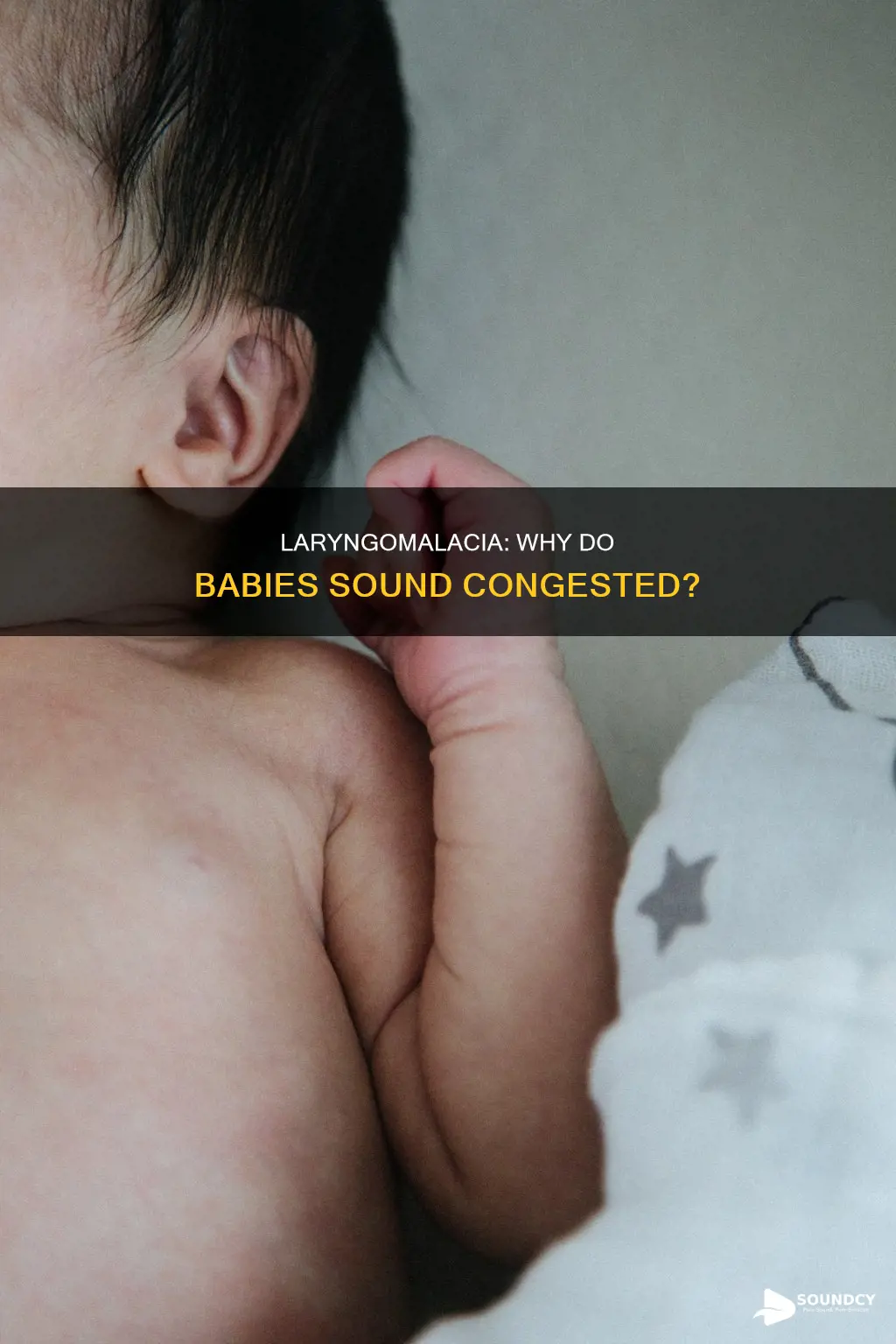 do babies with laryngomalacia sound congested