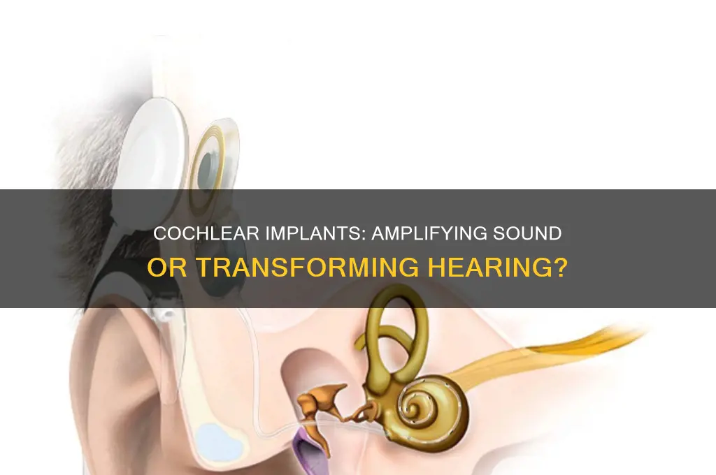 do cochlear implants amplify sound