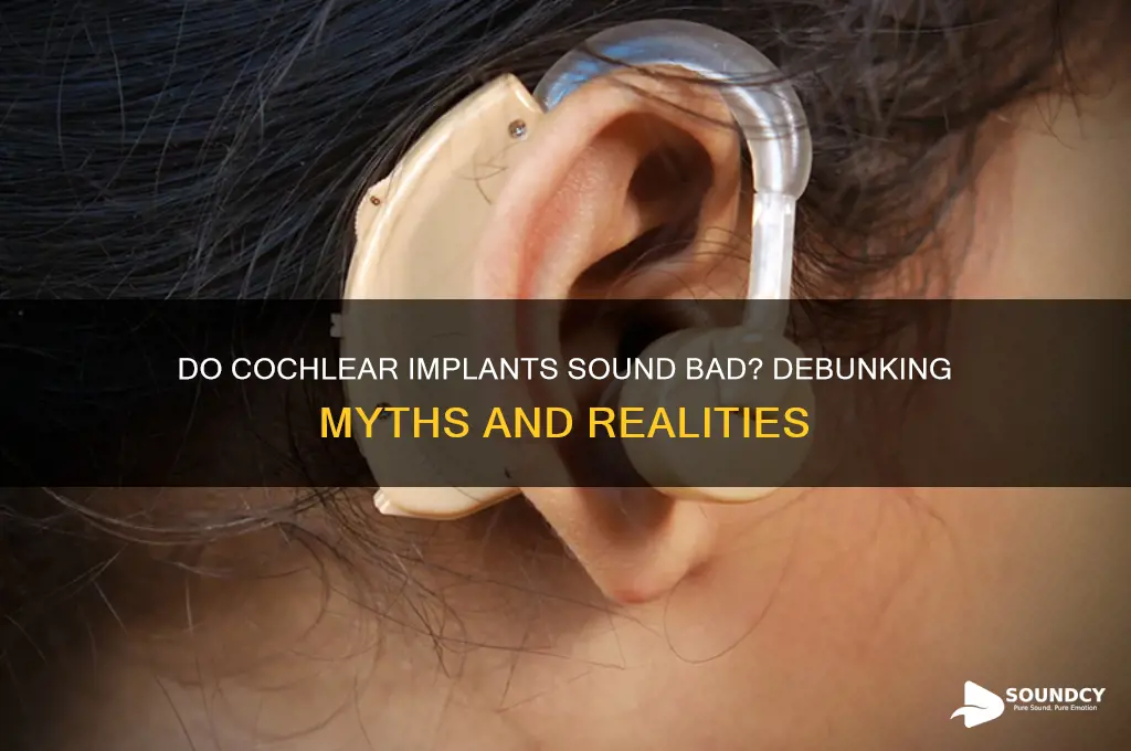 do cochlear implants sound bad