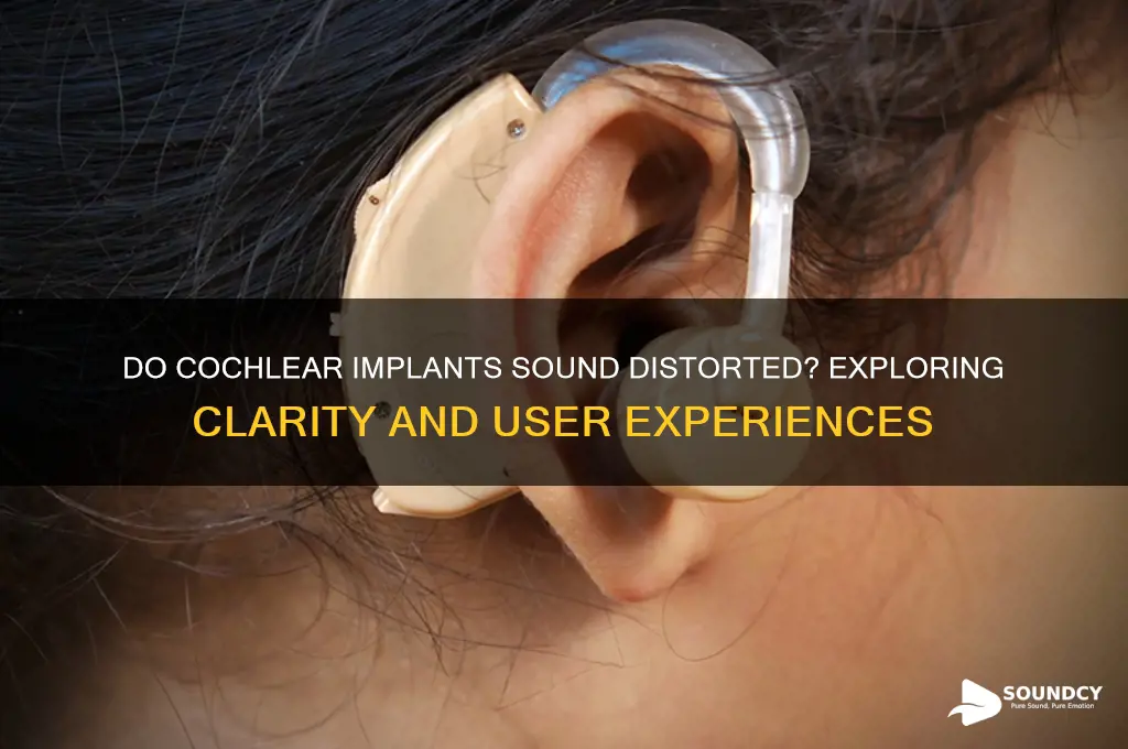 do cochlear implants sound distorted