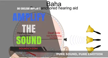 Cochlear Implants: Enhancing or Amplifying Sound?