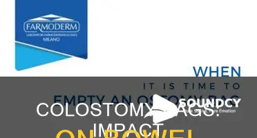 do colostomy bags affect bowel sounds