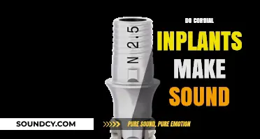 Do Cordial Implants Produce Noise? Exploring the Sounds of Dental Procedures
