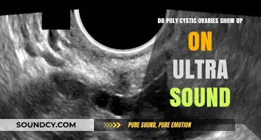 Can Ultrasound Detect Polycystic Ovaries? What to Expect