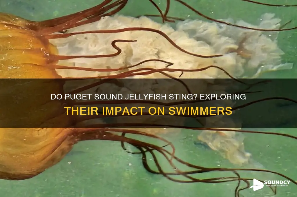 do puget sound jellyfish sting