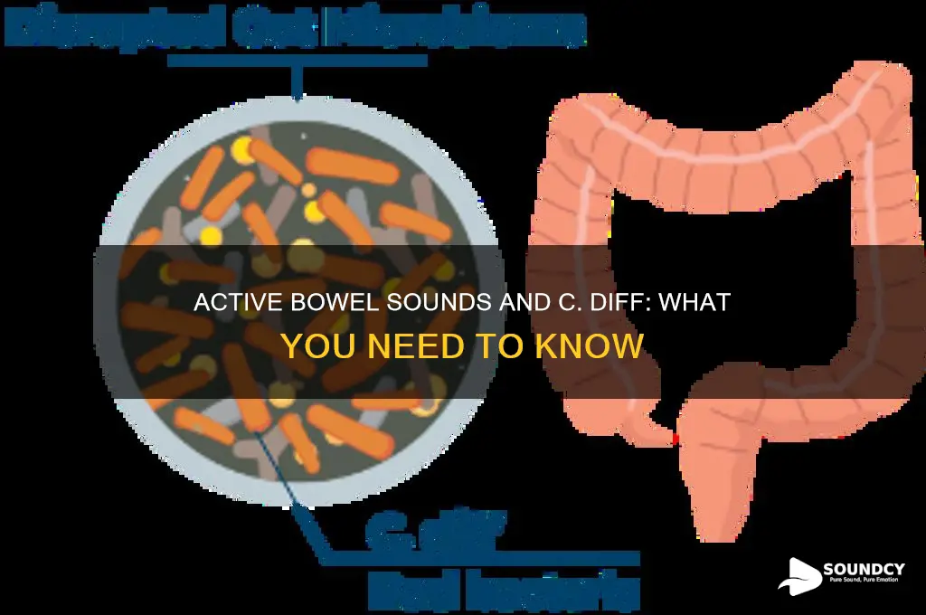 do u have active bowel sounds with c diff