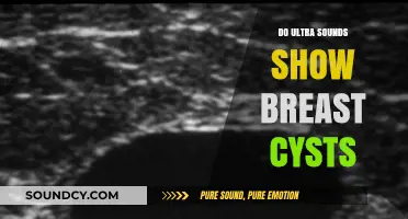 Breast Cysts: Can Ultrasounds Detect Them?