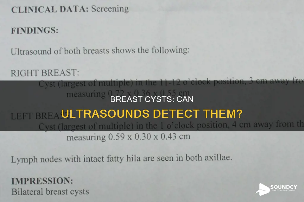 do ultra sounds show breast cysts