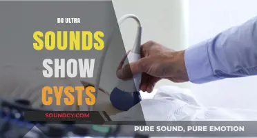 Can Ultrasounds Detect Cysts? Understanding Imaging and Diagnosis