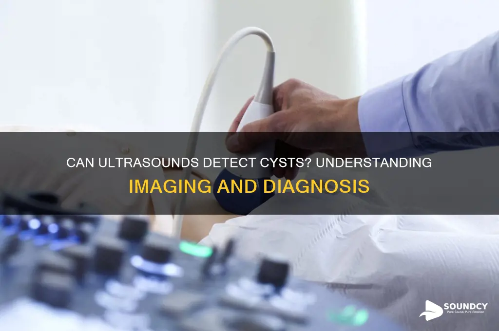 do ultra sounds show cysts