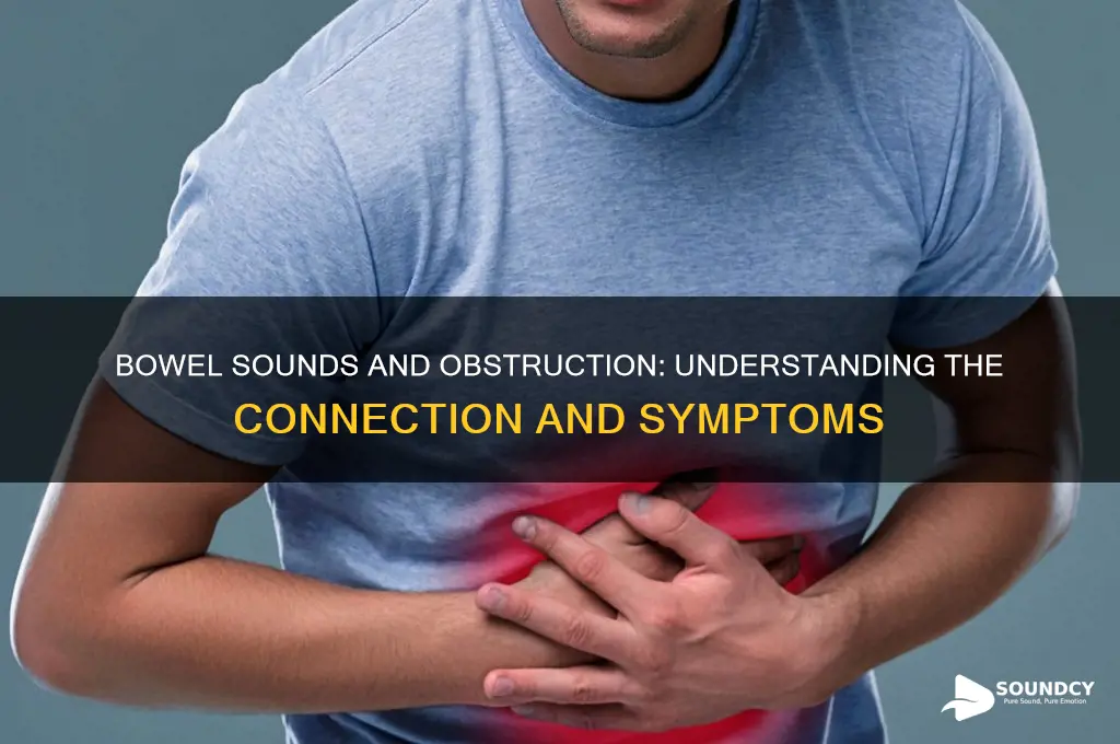 do you have bowel sounds with a bowel obstruction