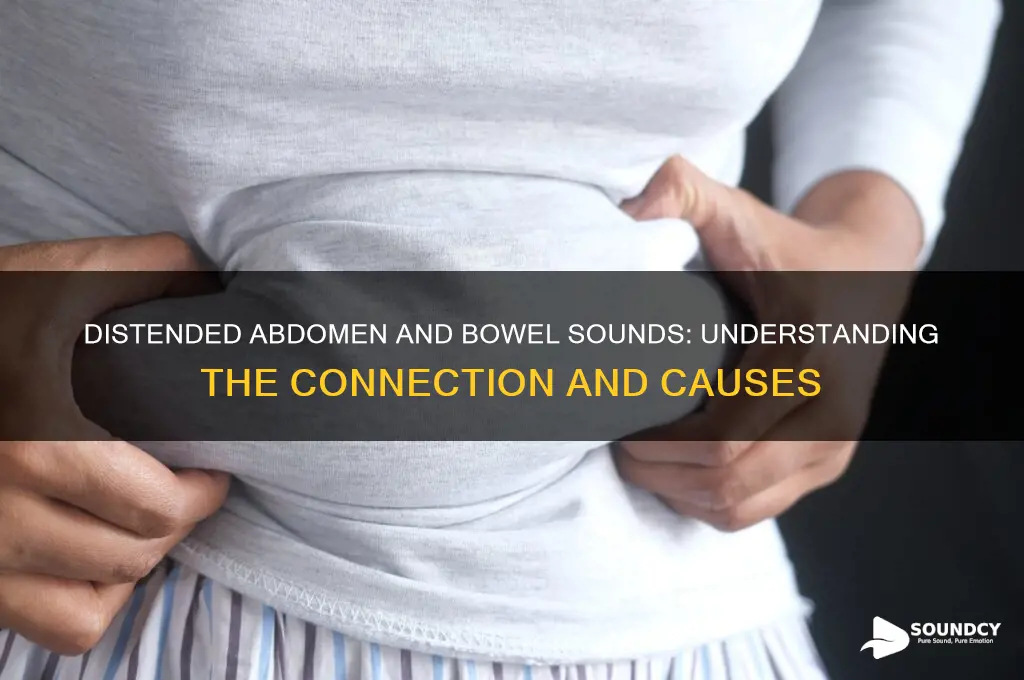 do you have bowel sounds with a distended abdomen