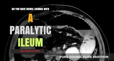 Paralytic Ileus and Bowel Sounds: What You Need to Know