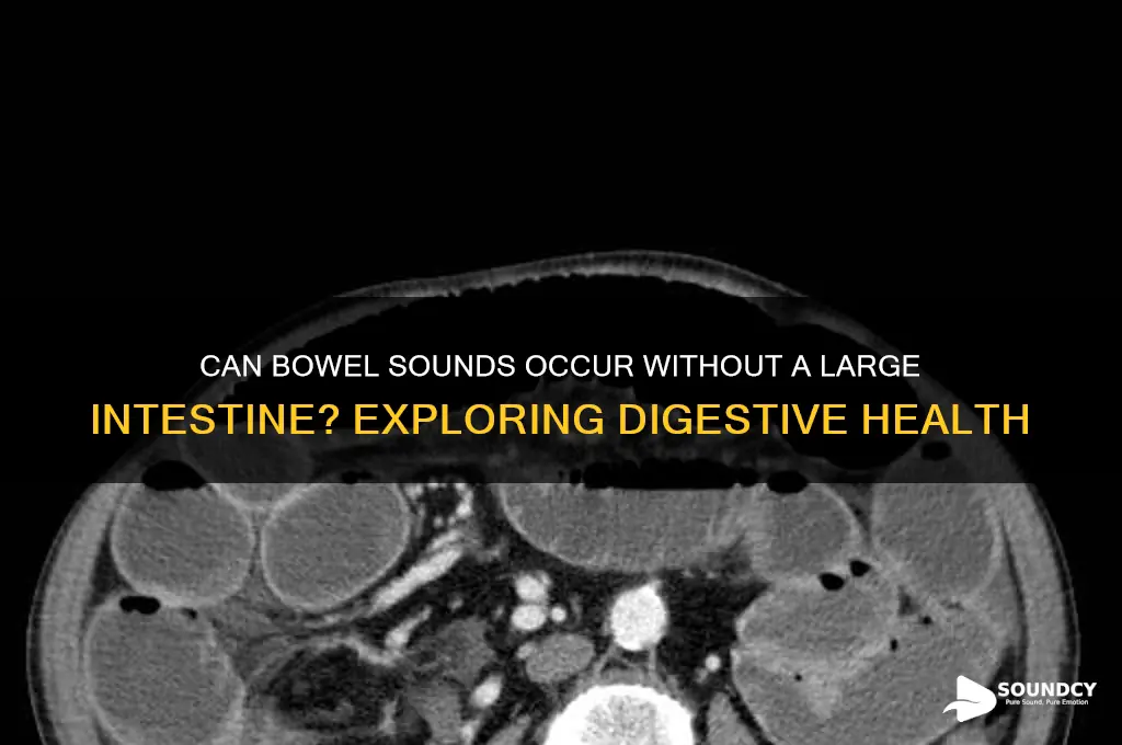 do you have bowel sounds without a large intestine
