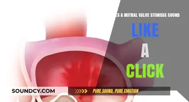 Mitral Valve Stenosis: Identifying the Distinct Click Sound and Symptoms