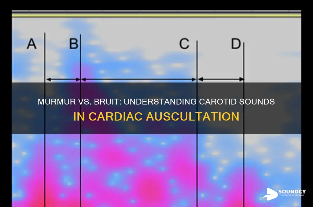 does a murmur radiating to carotids sound like bruit