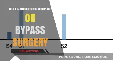 S4 Heart Sound: Angioplasty vs. Bypass Surgery – Which is Necessary?