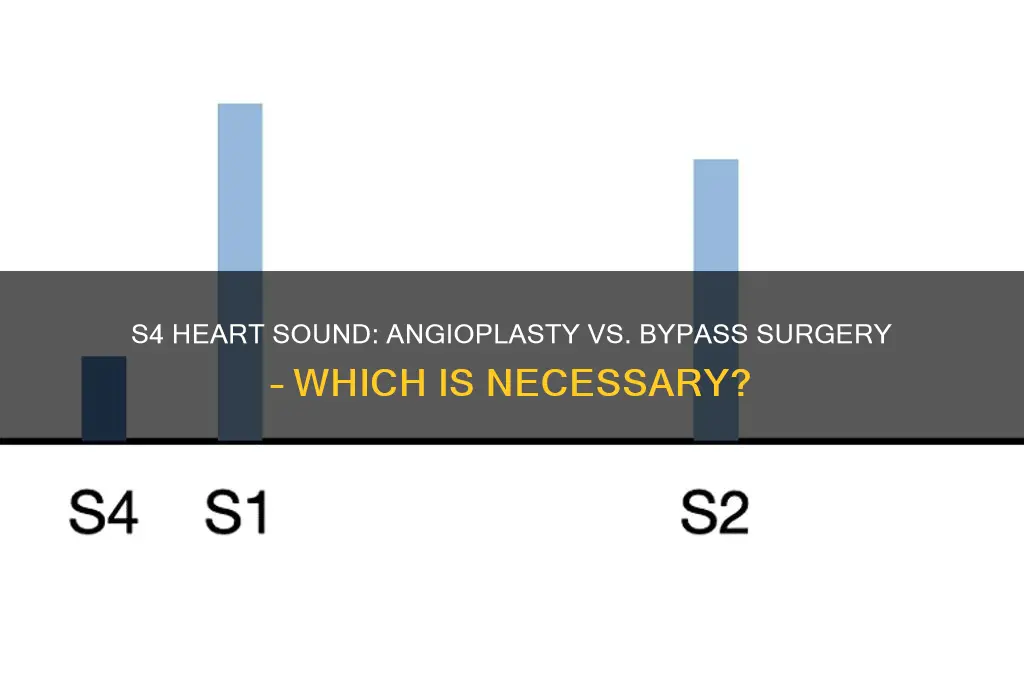 does a s4 sound require angioplasty or bypass surgery