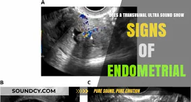 Transvaginal Ultrasound: Detecting Endometrial Cancer Signs and Early Warning