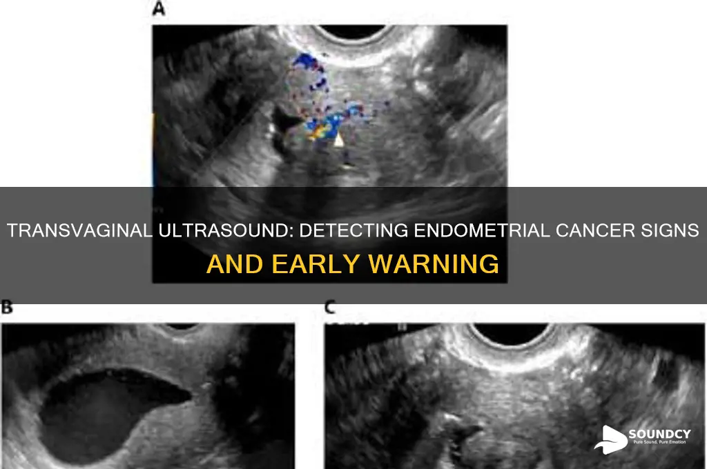 does a transvainal ultra sound show signs of endometrialcancer