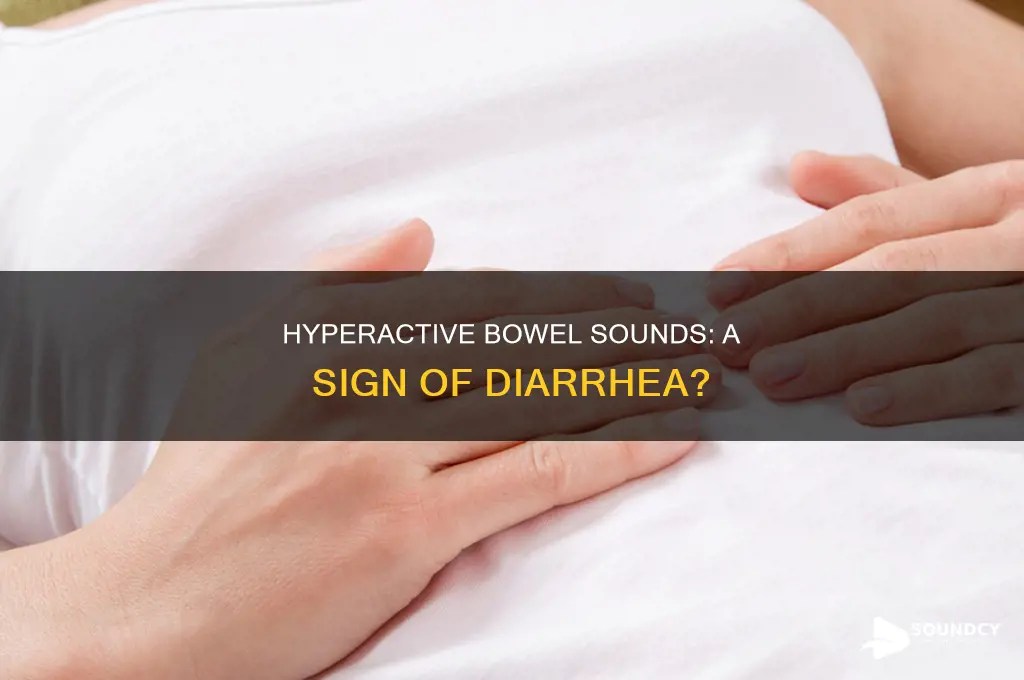 does diarrhea cause hyperactive bowel sounds