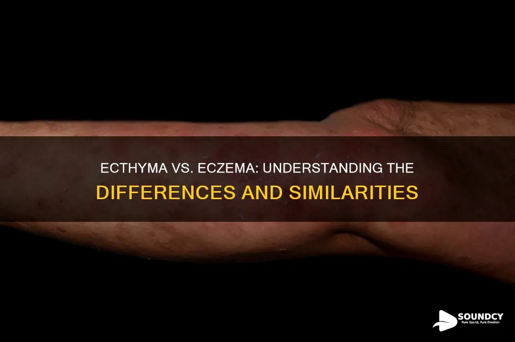 does ecthyma sound like eczema