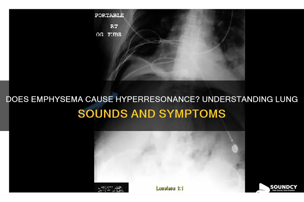 does emphysema cause hyperresonance sound