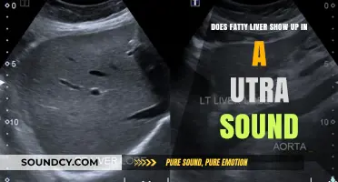 Can Ultrasound Detect Fatty Liver Disease? What to Expect
