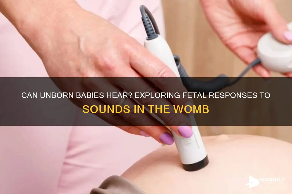 does fetus respond to sound