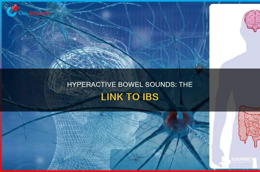 does ibs cause hyperactive bowel sounds