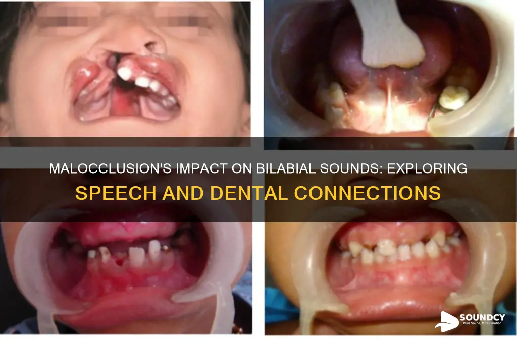 does malocclusion affect bilabial sounds