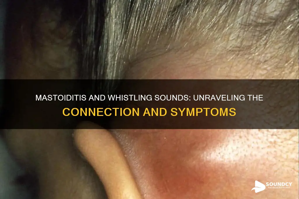 does mastoiditis causing whistling sounds