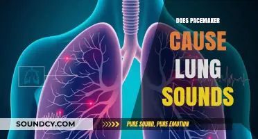 Can Pacemakers Cause Abnormal Lung Sounds? Exploring the Connection