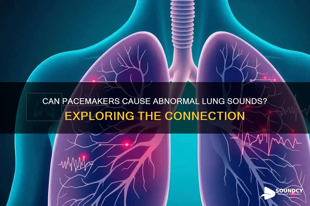 does pacemaker cause lung sounds