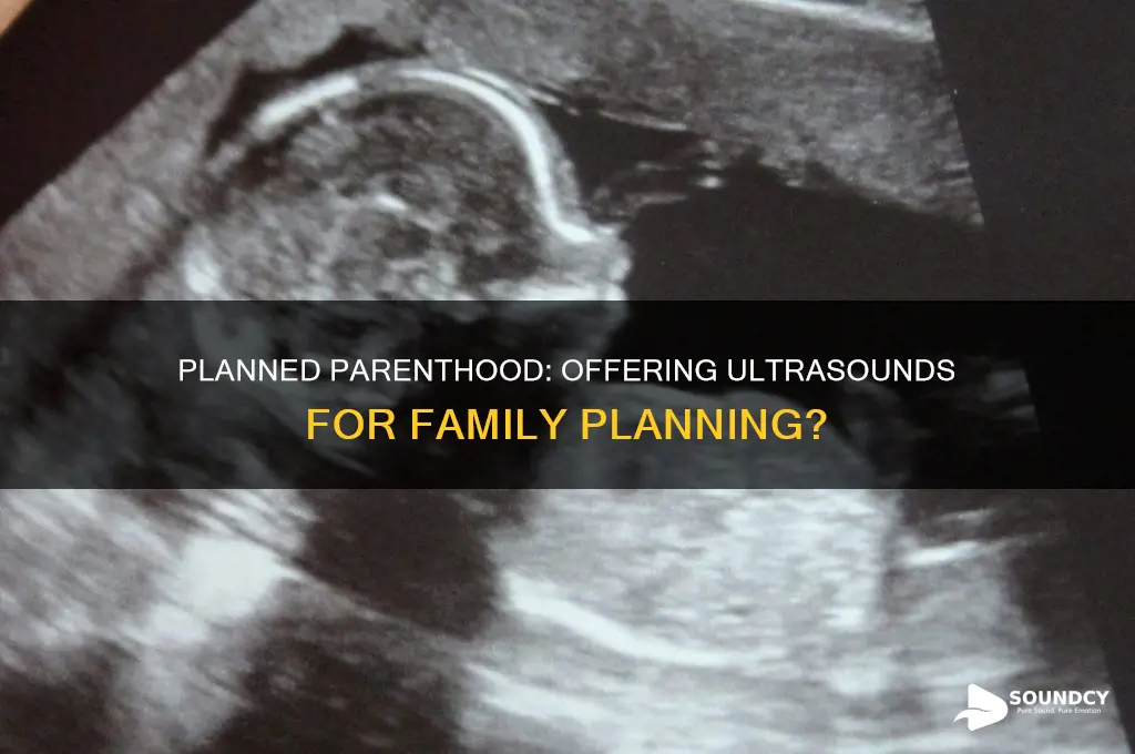 does planned parenthood do ultra sounds