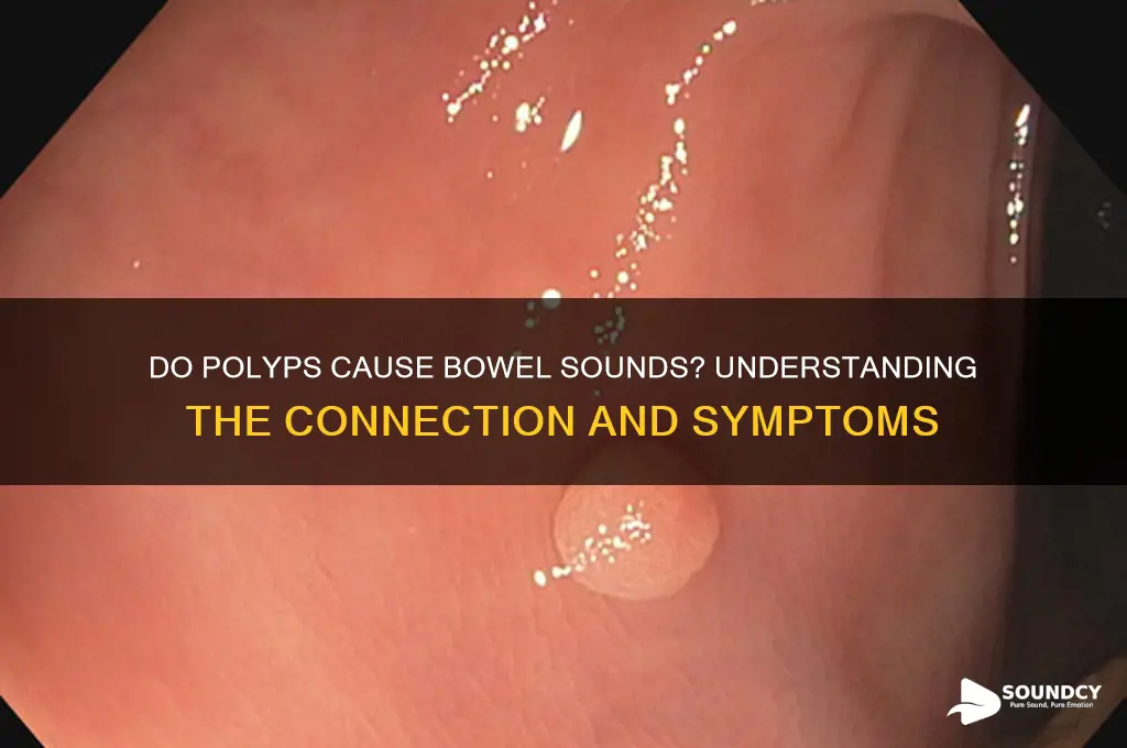 does polyp cause bowel sounds
