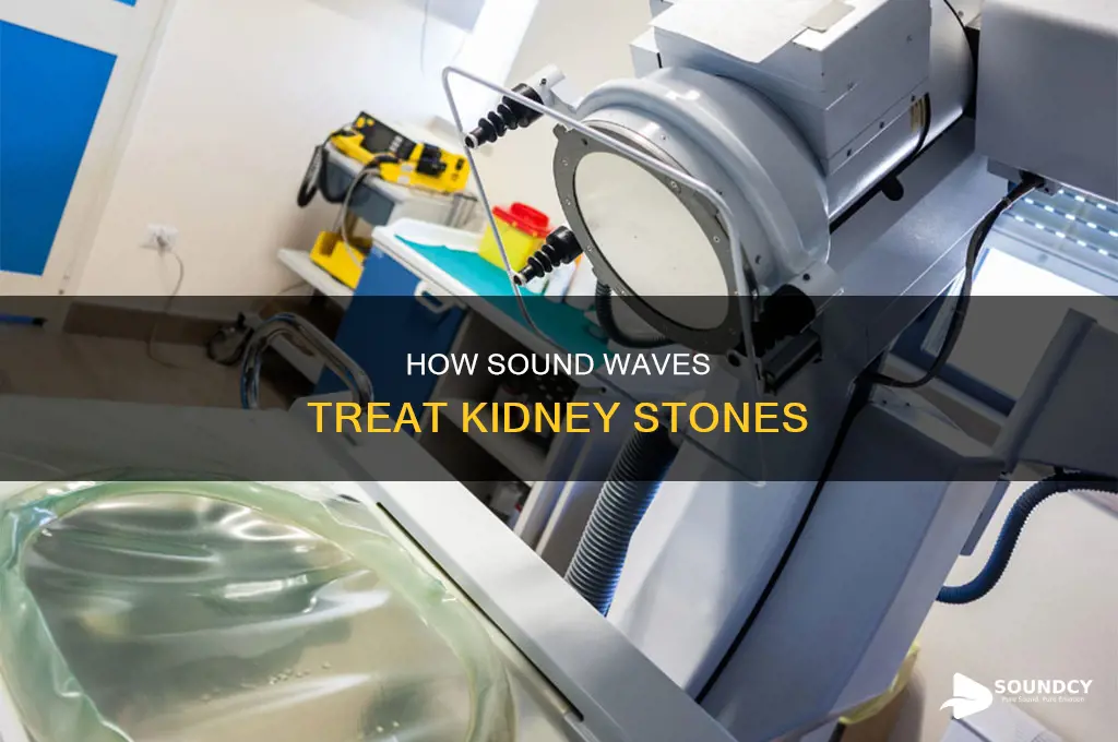 does sounding help with kidney stones