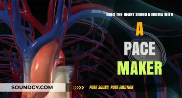 Heart Sounds with Pacemakers: Understanding Noroma and Cardiac Rhythms