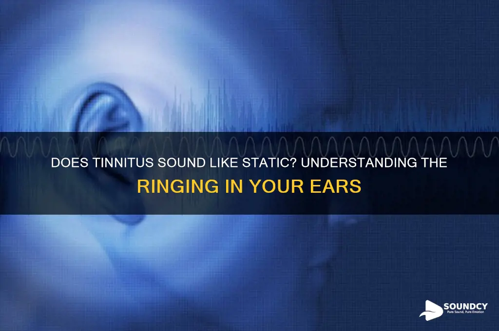 does tinnitus sound like static