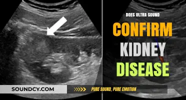Kidney Disease: Can Ultrasound Confirm It?