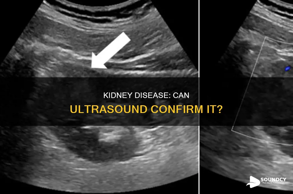 does ultra sound confirm kidney disease