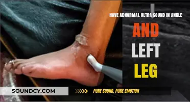 Understanding Abnormal Ultrasound Results in Ankle and Left Leg: A Guide