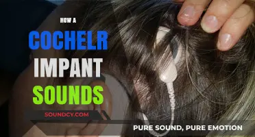 Hearing Through a Cochlear Implant: What Sounds Like to Users