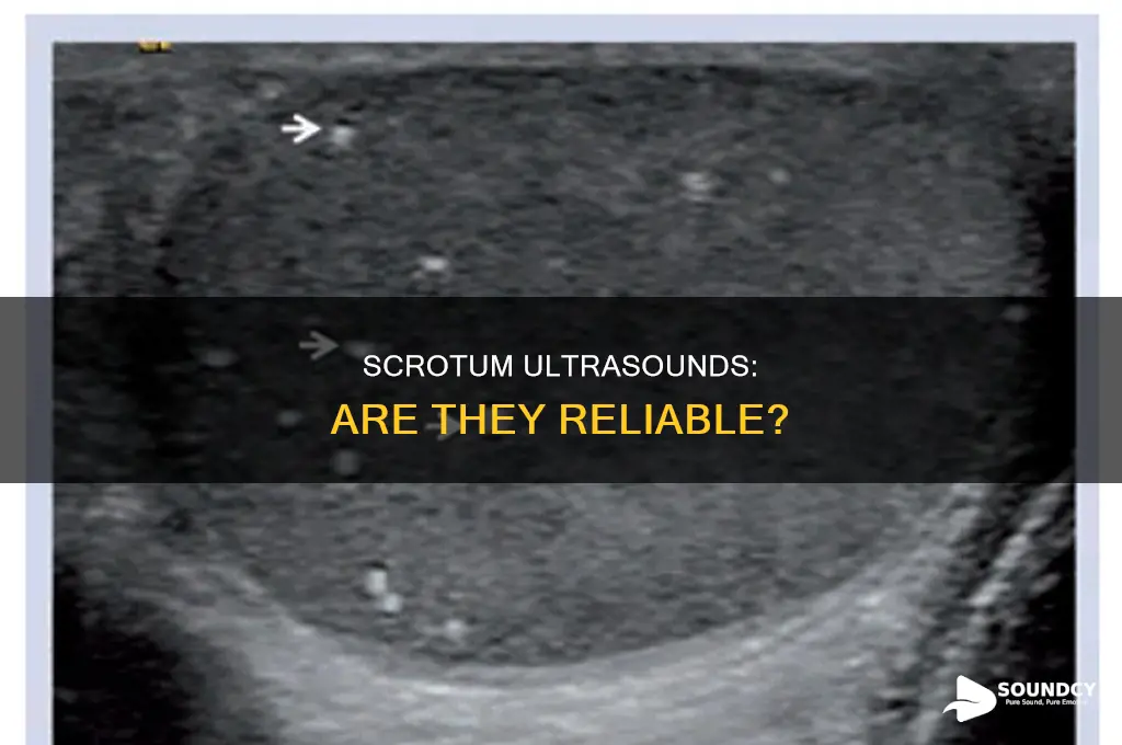 how accurate are srotum ultra sounds