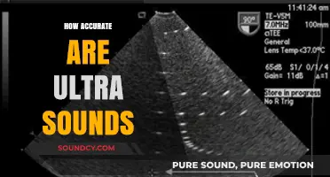 How Accurate Are Ultrasounds? Debunking Myths and Understanding Limits