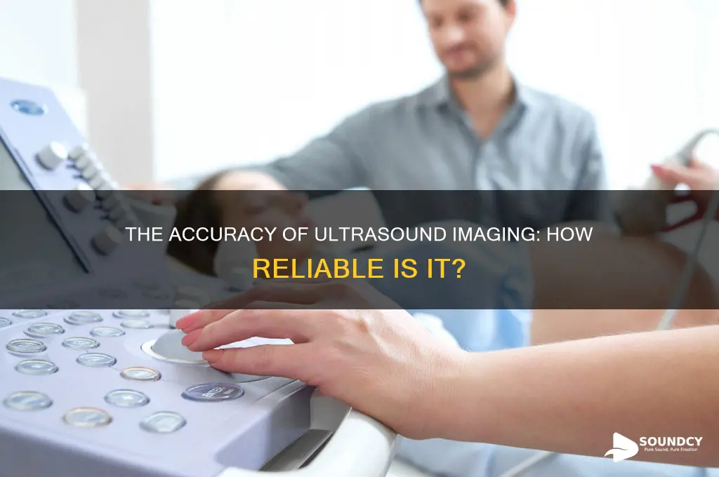 how accurate is ultra sound f