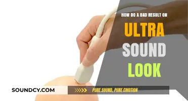 Understanding Abnormal Ultrasound Results: What a Bad Outcome Looks Like