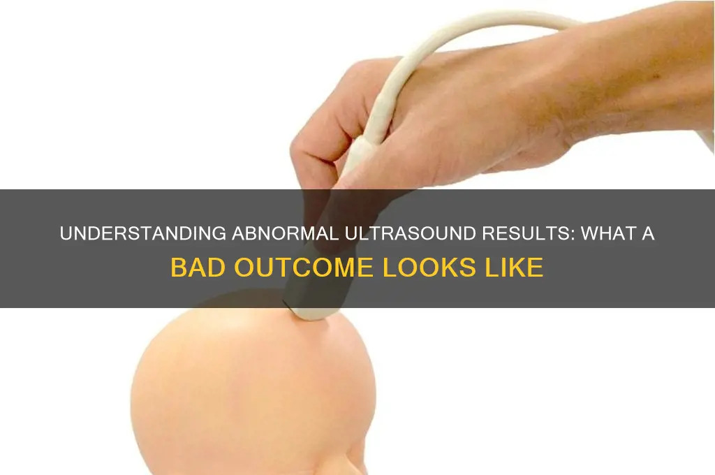 how do a bad result on ultra sound look