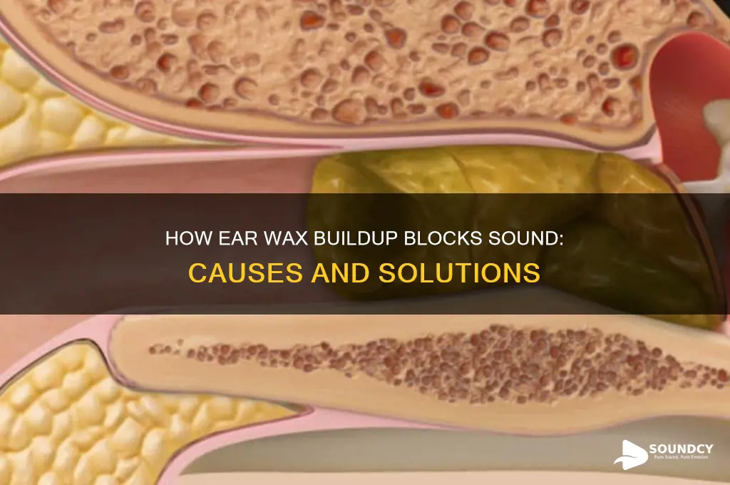 how do ear wax block sound